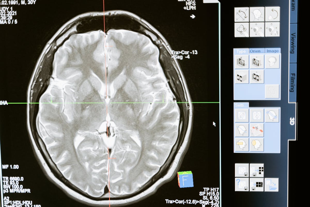 THC Does Not Just Blur Your Memory — A Controlled Study Found It Creates Confident Memories of Things That Never Happened